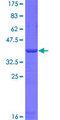 HERC6 Protein - 12.5% SDS-PAGE Stained with Coomassie Blue.