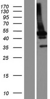 HERPUD1 / HERP Protein - Western validation with an anti-DDK antibody * L: Control HEK293 lysate R: Over-expression lysate