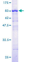 HERPUD1 / HERP Protein - 12.5% SDS-PAGE of human HERPUD1 stained with Coomassie Blue