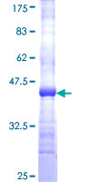HERPUD1 / HERP Protein - 12.5% SDS-PAGE Stained with Coomassie Blue.
