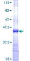 HERPUD1 / HERP Protein - 12.5% SDS-PAGE Stained with Coomassie Blue.