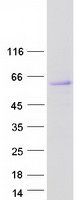 HERPUD1 / HERP Protein - Purified recombinant protein HERPUD1 was analyzed by SDS-PAGE gel and Coomassie Blue Staining