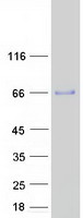 HERPUD2 Protein - Purified recombinant protein HERPUD2 was analyzed by SDS-PAGE gel and Coomassie Blue Staining