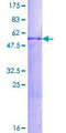 HES1 / HES-1 Protein - 12.5% SDS-PAGE of human HES1 stained with Coomassie Blue