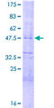 HES4 Protein - 12.5% SDS-PAGE of human HES4 stained with Coomassie Blue