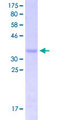 HES5 Protein - 12.5% SDS-PAGE Stained with Coomassie Blue.