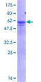 HES6 Protein - 12.5% SDS-PAGE of human HES6 stained with Coomassie Blue