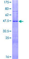HESX1 Protein - 12.5% SDS-PAGE of human HESX1 stained with Coomassie Blue