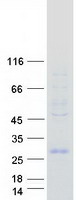 HESX1 Protein - Purified recombinant protein HESX1 was analyzed by SDS-PAGE gel and Coomassie Blue Staining