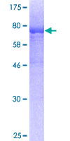 HEXA Protein - 12.5% SDS-PAGE of human HEXA stained with Coomassie Blue