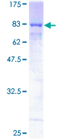 HEXIM1 Protein - 12.5% SDS-PAGE of human HEXIM1 stained with Coomassie Blue