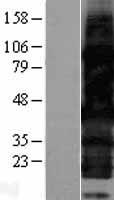 HEXIM2 Protein - Western validation with an anti-DDK antibody * L: Control HEK293 lysate R: Over-expression lysate