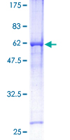 HEY1 Protein - 12.5% SDS-PAGE of human HEY1 stained with Coomassie Blue