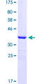 HEY1 Protein - 12.5% SDS-PAGE Stained with Coomassie Blue.