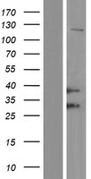 HFE Protein - Western validation with an anti-DDK antibody * L: Control HEK293 lysate R: Over-expression lysate