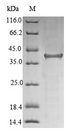 HFE Protein - (Tris-Glycine gel) Discontinuous SDS-PAGE (reduced) with 5% enrichment gel and 15% separation gel.