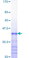 HFE Protein - 12.5% SDS-PAGE Stained with Coomassie Blue.