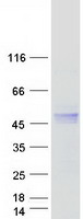 HFE Protein - Purified recombinant protein HFE was analyzed by SDS-PAGE gel and Coomassie Blue Staining