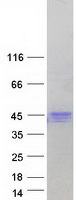 HFE Protein - Purified recombinant protein HFE was analyzed by SDS-PAGE gel and Coomassie Blue Staining