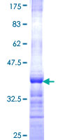 HFE2 / Hemojuvelin Protein - 12.5% SDS-PAGE Stained with Coomassie Blue.