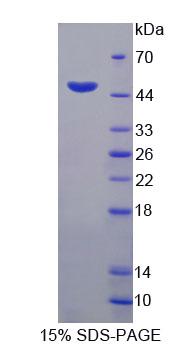 HFE2 / Hemojuvelin Protein - Recombinant Hemojuvelin (HJV) by SDS-PAGE