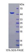 HFE2 / Hemojuvelin Protein - Recombinant Hemojuvelin (HJV) by SDS-PAGE