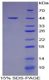 HFE2 / Hemojuvelin Protein - Recombinant Hemojuvelin By SDS-PAGE
