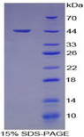 HFE2 / Hemojuvelin Protein - Recombinant Hemojuvelin By SDS-PAGE