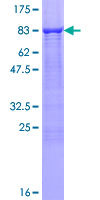 HFH-4 / FOXJ1 Protein - 12.5% SDS-PAGE of human FOXJ1 stained with Coomassie Blue