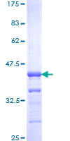 HFH-4 / FOXJ1 Protein - 12.5% SDS-PAGE Stained with Coomassie Blue.