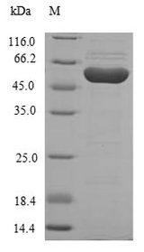 HGD Protein - (Tris-Glycine gel) Discontinuous SDS-PAGE (reduced) with 5% enrichment gel and 15% separation gel.