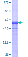 HGD Protein - 12.5% SDS-PAGE of human HGD stained with Coomassie Blue