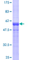 HGD Protein - 12.5% SDS-PAGE of human HGD stained with Coomassie Blue