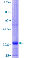 HGD Protein - 12.5% SDS-PAGE Stained with Coomassie Blue.