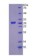 HGD Protein - Recombinant Homogentisate-1,2-Dioxygenase By SDS-PAGE