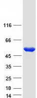 HGD Protein - Purified recombinant protein HGD was analyzed by SDS-PAGE gel and Coomassie Blue Staining