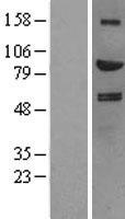 HGF / Hepatocyte Growth Factor Protein - Western validation with an anti-DDK antibody * L: Control HEK293 lysate R: Over-expression lysate