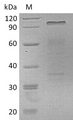 HGF / Hepatocyte Growth Factor Protein - (Tris-Glycine gel) Discontinuous SDS-PAGE (reduced) with 5% enrichment gel and 15% separation gel.