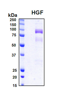HGF / Hepatocyte Growth Factor Protein - SDS-PAGE under reducing conditions and visualized by Coomassie blue staining