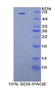 HGF / Hepatocyte Growth Factor Protein - Recombinant Hepatocyte Growth Factor By SDS-PAGE