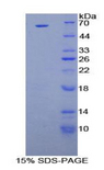 HGF / Hepatocyte Growth Factor Protein - Recombinant Hepatocyte Growth Factor By SDS-PAGE