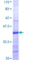 HGF / Hepatocyte Growth Factor Protein - 12.5% SDS-PAGE Stained with Coomassie Blue.