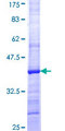 HGF / Hepatocyte Growth Factor Protein - 12.5% SDS-PAGE Stained with Coomassie Blue.