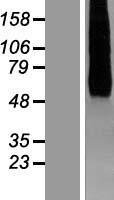 HHATL Protein - Western validation with an anti-DDK antibody * L: Control HEK293 lysate R: Over-expression lysate