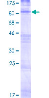 HHATL Protein - 12.5% SDS-PAGE of human HHATL stained with Coomassie Blue