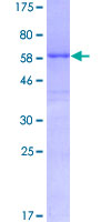 HHEX / HEX Protein - 12.5% SDS-PAGE of human HHEX stained with Coomassie Blue