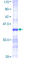 HHIP / HIP Protein - 12.5% SDS-PAGE Stained with Coomassie Blue.