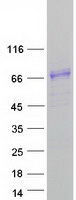 HHIPL1 Protein - Purified recombinant protein HHIPL1 was analyzed by SDS-PAGE gel and Coomassie Blue Staining