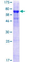 HHLA2 Protein - 12.5% SDS-PAGE of human HHLA2 stained with Coomassie Blue