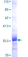 HHLA3 Protein - 12.5% SDS-PAGE Stained with Coomassie Blue.